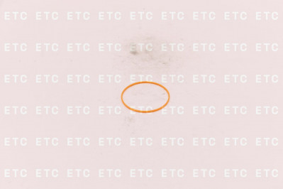 1102306 Ремкомплект гидроцилиндра ковша